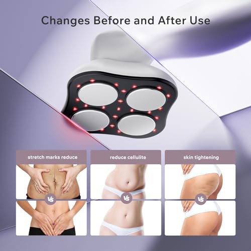 Body Sculpting Machine - Cellulite Massager Tool with Heating Skin Tightening for Home Use, Cellulite Remover for Belly, Legs, Belly, Arms, Buttocks, Wireless & Lightweight