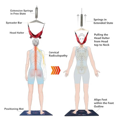 LittleMum Spring-Controlled Cervical Traction System, Sheepskin Halter - color: Red-sheepskin Head Halter