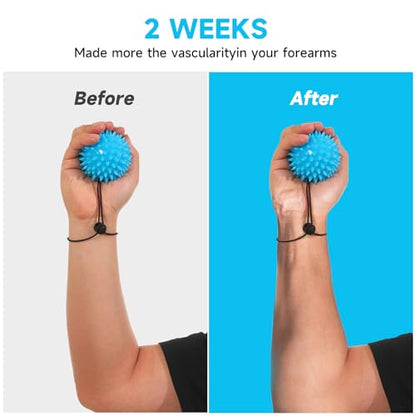 Hand Exerciser Finger Strengthener Balls, Stress Balls Squeeze Balls