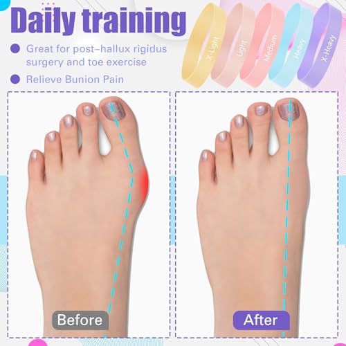 Set of 5 Toe Stretcher Band Separator Spacer Bunion Correction Hallux Valgus Alignment Foot Stretcher Straightener Resistance Loop Yoga Exercise Foot Care with Carry Bag(Pastel)