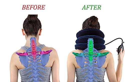 RUNZI Cervical Neck Traction Device Inflatable Neck Stretcher, Easy to Use for Chronic Neck and Shoulder Pain Relief Traction Spine Alignment, Neck Cervical Brace