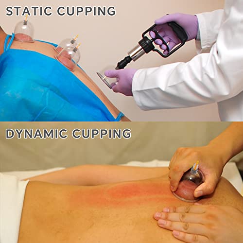 Cupping Therapy Set, 24 Massage Cups Cupping Set with Pump Vacuum Suction Cups for Body Cellulite Massage Back Pain Relief, Chinese Acupoint Physical Hijama