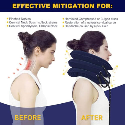 Neck Stretcher, Cervical Traction Device, Neck Traction Device, Cervical Neck Traction Device for Neck Pain Relief, Adjustable Inflatable Neck Brace, Neck Decompression Home Use (Blue) - color: Blue