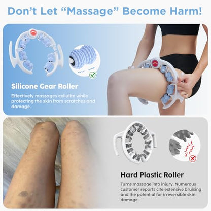 Cellulite Massage Tool, Anti-Cellulite Roller- Lymphatic Drainage Massager - Muscle Roller, Deep Fascia Massage, Dimpled Skin Removal, Legs/Thighs/Buttocks, Smooth Skin (14 Wheel - Blue) - color: 14 Wheel -White Blue