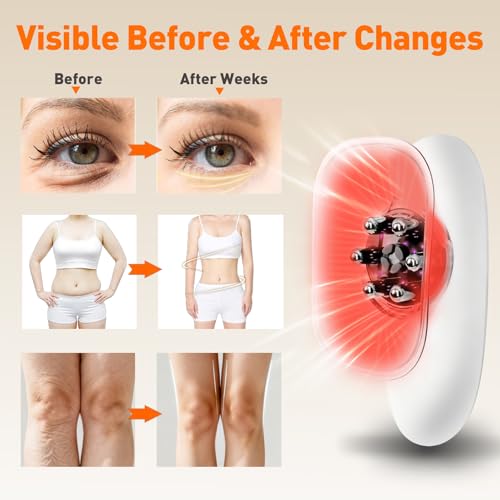 3-in-1 Body Sculpting Machine, 3 Modes Adjustable Cellulite Machine, 3-in-1 Handle Body Sculptor-Suitable for Back, Belly, Waist, Arms, Legs, Reduce Stretch Marks & Tightens Skin