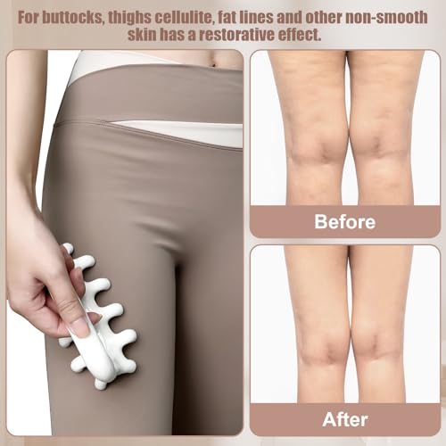 Fascia Massage Tool Trigger Point Massage Tools Anti Blaster for Cellulite Massage Tool Reaching Deep Myofascial Tissue Throughout The Body Release Muscle Knot Reduction Cellulite