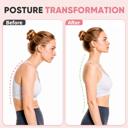 Figure 8 Resistance Bands for Women & Men, Exercise Bands for Arms, Shoulder, Leg & Back Stretching, Non-Slip Handles, Home Gym, Yoga & Physical Therapy - Toning, Posture Correction