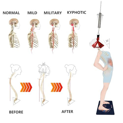 LittleMum Spring-Controlled Cervical Traction System, Sheepskin Halter - color: Red-sheepskin Head Halter