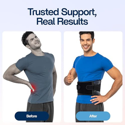 Back Brace for Lower Back Pain Relief | Sciatica Lumbar Support Belt for Men & Women, Adjustable Back Support Brace for Work & Daily Use, All-Day Comfort & Heavy-Duty Compression (Small (28-32.9"))