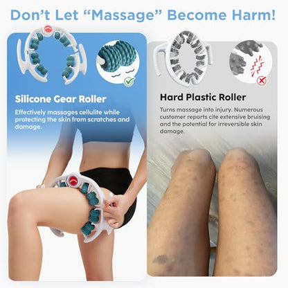 Cellulite Massage Tool, Anti-Cellulite Roller- Lymphatic Drainage Massager - Muscle Roller, Deep Fascia Massage, Dimpled Skin Removal, Legs/Thighs/Buttocks, Smooth Skin (14 Wheel - Green) - color: 14 Wheel -White Green