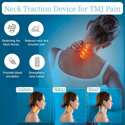 Neck Hump Corrector, Neck Stretcher Cervical Traction for Muscle Relax, Cervical Traction Device for TMJ Pain Relief, Spine Corrector, Shoulder Relief Device (Blue)