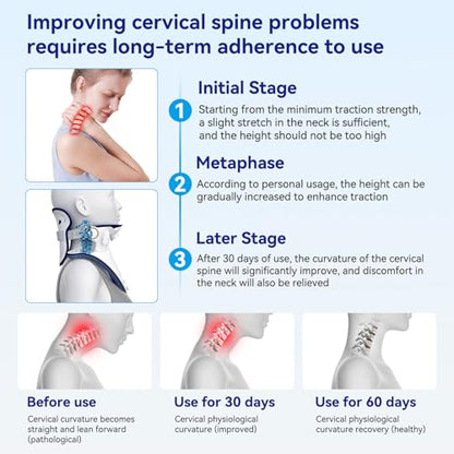 Cervical Traction Device Neck Brace Support Stretcher for Pain Relief