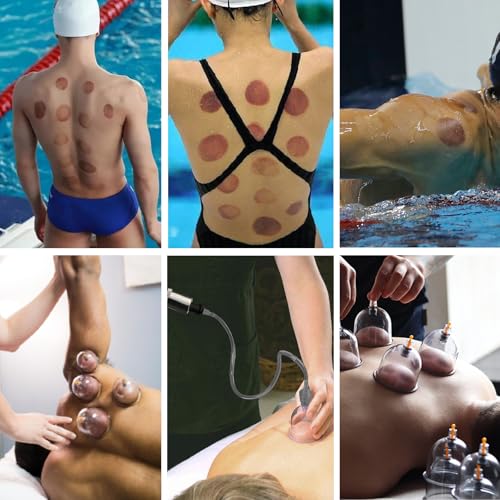 Cupping Set, 19 Cups Cupping Kit for Massage Therapy, Cupping Therapy Set with Pump for Back Massage, Pain Relief, Physical Therapy - size: 19 Cups