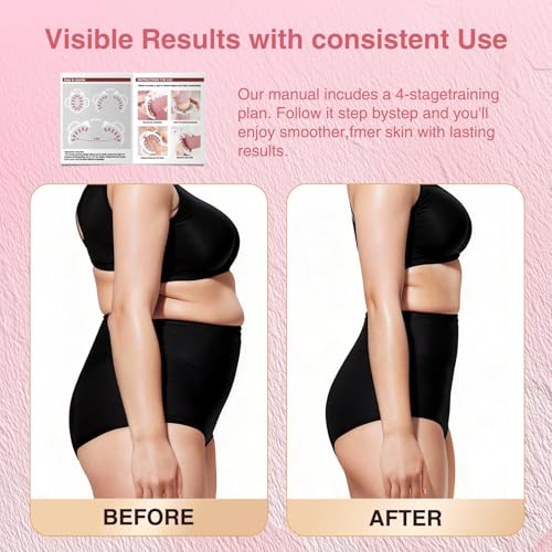 Lymphatic Drainage Massager Roller–Fascia Blaster Tool for Legs,Thighs,and Calves –Deep Tissue Body Sculpting and Anti-Cellulite Massager Tool