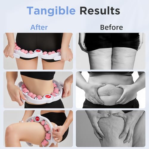 Cellulite Massage Tool - Lymphatic Drainage Massager - Muscle Roller, Deep Fascia Massage, Dimpled Skin Removal, Legs/Thighs/Buttocks, Anti-Cellulite Roller, Smooth Skin (14 Wheel - Pink) - color: White Pink