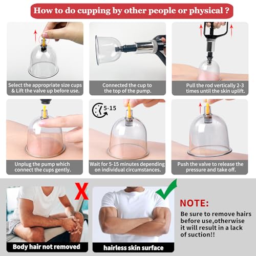 Cupping Set, 19 Cups Cupping Kit for Massage Therapy, Cupping Therapy Set with Pump for Back Massage, Pain Relief, Physical Therapy - size: 19 Cups