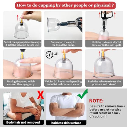 Cupping Set, 19 Cups Cupping Kit for Massage Therapy, Cupping Therapy Set with Pump for Back Massage, Pain Relief, Physical Therapy - size: 19 Cups