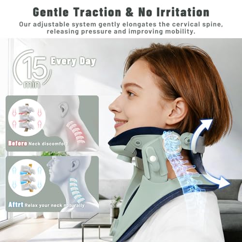 Zenopax Neck Stretcher Cervical Traction, Adjustable Neck Traction Device, Neck Stretcher for Neck Pain Relief with Dual-Adjustable Chin Rest, Ergonomic & Breathable for Home Use, Office(Olive Green)