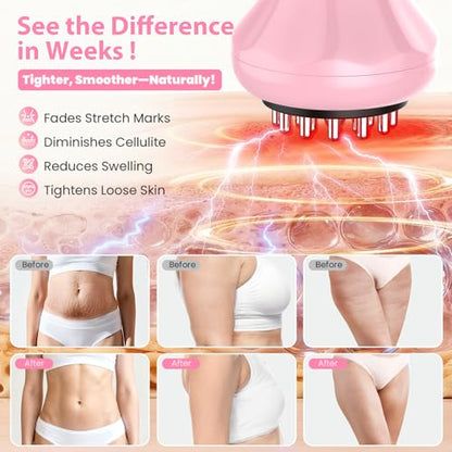 Lymphatic Drainage Massager, Anti Cellulite Massage Tool For Thigh & Belly Stretch Marks & Cellulite Reduction, Handheld Massage tools for Sciatica Nerve, Legs, Arms, Hip, Muscle, Low Back Pain Relief