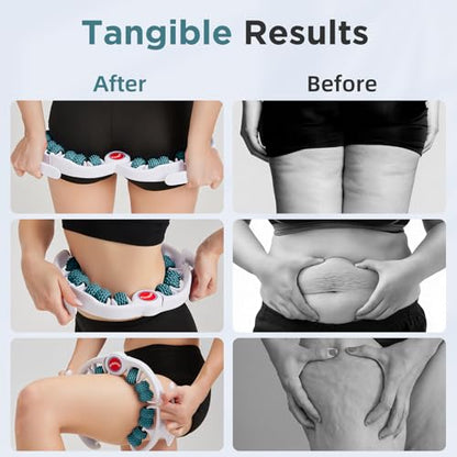 Cellulite Massage Tool, Anti-Cellulite Roller- Lymphatic Drainage Massager - Muscle Roller, Deep Fascia Massage, Dimpled Skin Removal, Legs/Thighs/Buttocks, Smooth Skin (14 Wheel - Green) - color: 14 Wheel -White Green