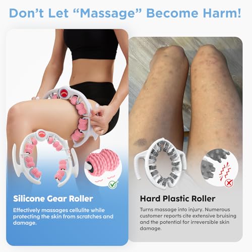 Cellulite Massage Tool, Anti-Cellulite Roller - Lymphatic Drainage Massager - Muscle Roller, Deep Fascia Massage, Dimpled Skin Removal, Legs/Thighs/Buttocks, Smooth Skin (14 Wheel - Pink) - color: 14 Wheel -White Pink