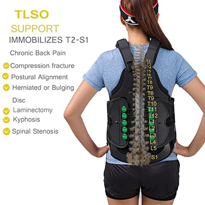 TLSO Thoracic Full Back Brace for Men Women for Kyphosis, Post Op Recovery, Compression Fractures, Scoliosis, DDD, Herniated Discs, Adjustable Thoracic Lumbar Spine Support (Size Large)