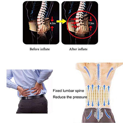 Goldmille Decompression Back Belt Lumbar Traction Device for Lower Back Pain, Lower Back Brace Inflatable - One Size for 29-49 Waist